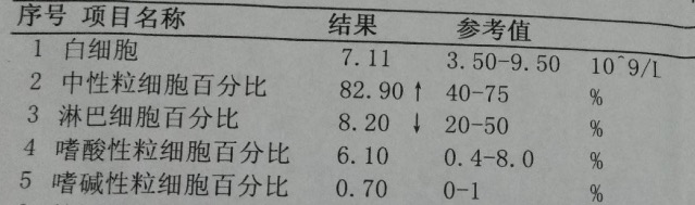 占据用户心智，产物司理要降服抽象思维