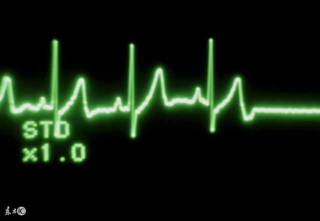 正常的心跳是多少？心跳超过这个数字要看医生！