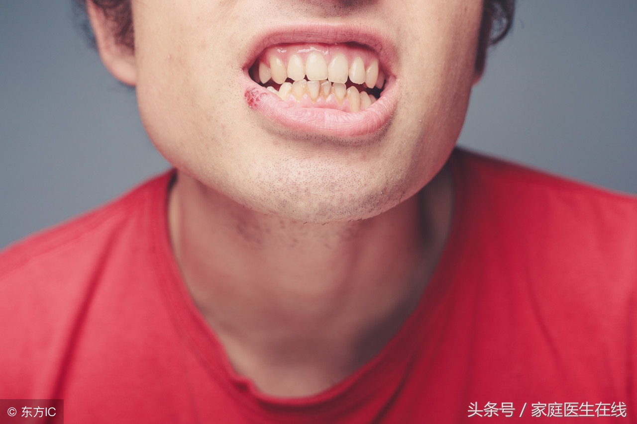 黄牙变白牙？黄牙怎么变白的简单法