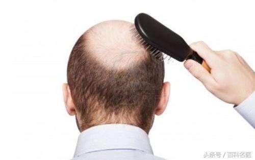 经常掉头发怎么办？4种方法教你告别脱发！