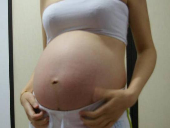 孕妇怀孕8个月，孕检发现胎儿胎位不正，原因却是吃的有问题！