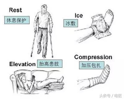 骨科科普：脚踝扭伤了怎么办？别再揉了，这才是正确处理方式！