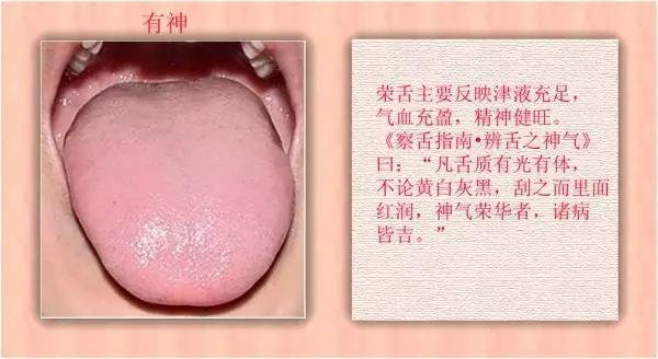 老中医舌珍总结：九种体质+珍贵的舌诊图谱，拿镜子看看