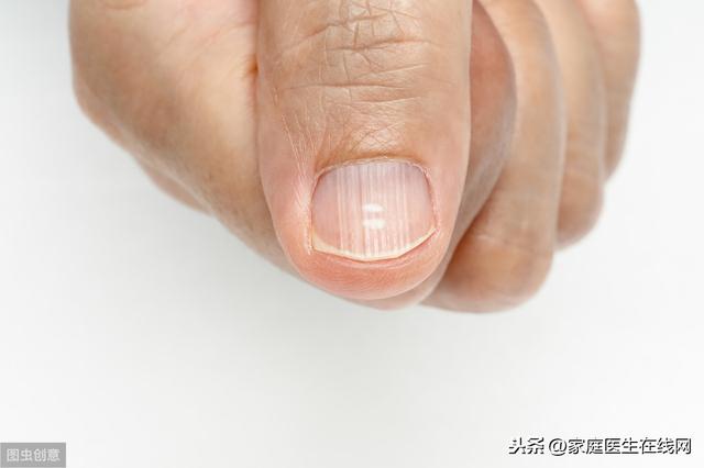 指甲有竖纹是身体的什么信号？指甲有竖纹是怎么回事？