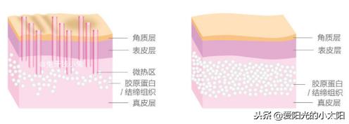 是噱头还是真本事？11款网红超人气家用美容仪实测经验分享