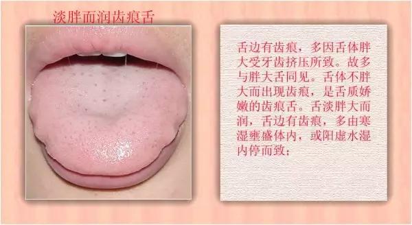 老中医舌珍总结：九种体质+珍贵的舌诊图谱，拿镜子看看