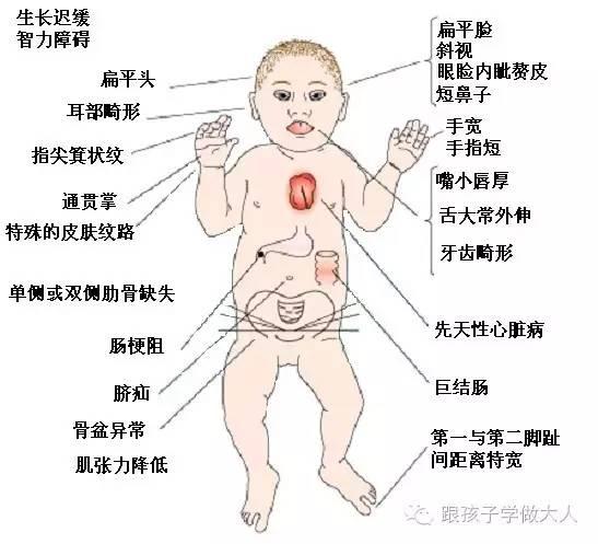 怀孕15周要唐氏筛查，筛查的方法是什么？准妈要做什么准备？