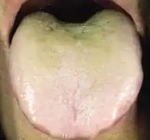 老中医舌珍总结：九种体质+珍贵的舌诊图谱，拿镜子看看