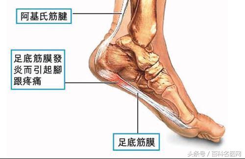 脚后跟疼痛，不红不肿是怎么回事？原因有哪些？