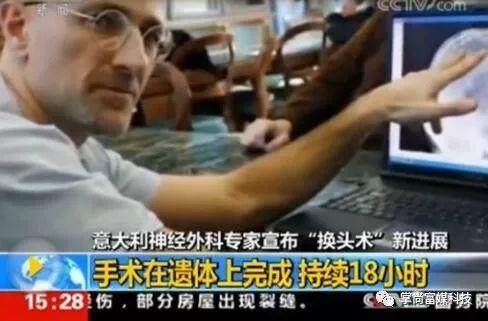 争议！世界首例头颅移植手术在中国成功