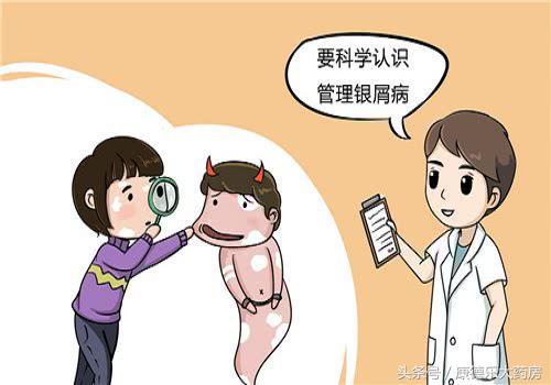 偏方治疗牛皮癣的方法可行吗？这里告诉您，不看别后悔