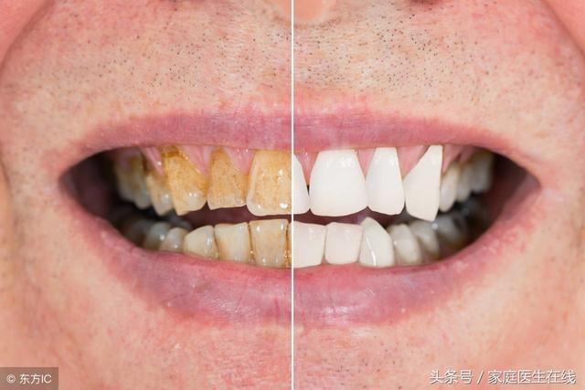 牙齿黄怎么办？这三个方法，不用洗牙就能美白牙齿